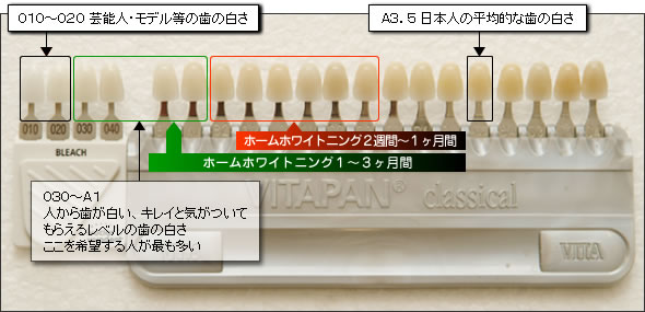 ホワイトニング比較