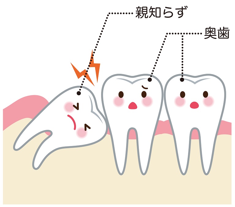 親知らず